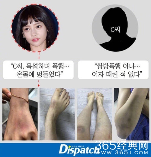 剧情大反转 具荷拉子宫出血 室友证男方拳打脚踢