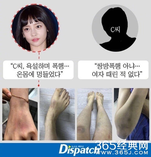 具荷拉男友称验伤单是假的 否认殴打女方