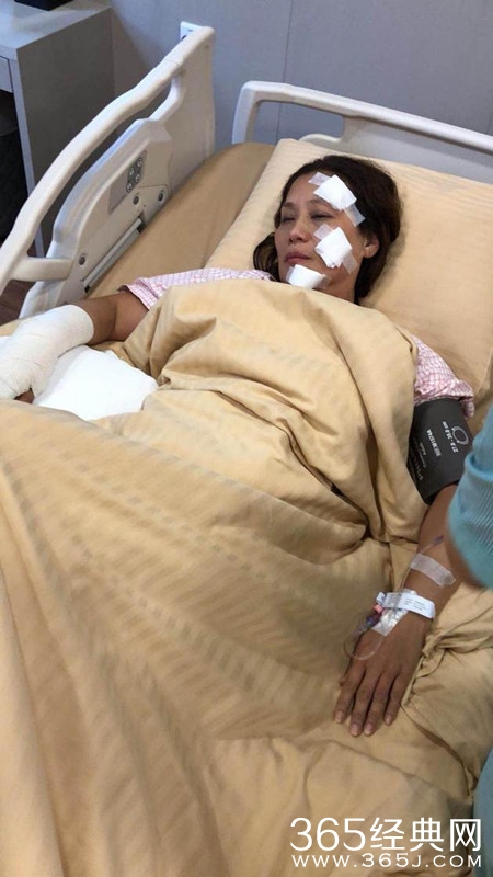 杨盼盼片场烧伤 女儿报平安 暂不考虑回港就医