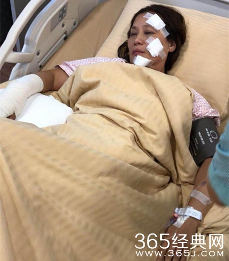 杨盼盼片场烧伤 目前正在留院观察