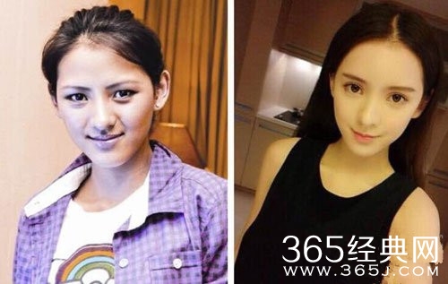 张予曦回应外貌争议 整容前后对比照曝光