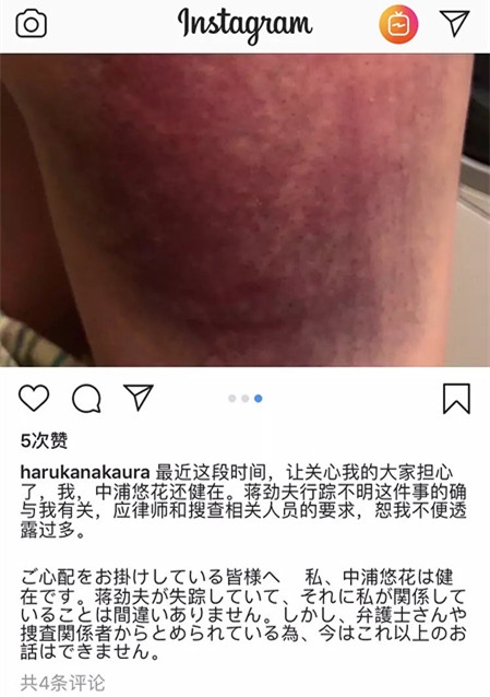 蒋劲夫行踪不明 女友晒淤青照 疑似家暴