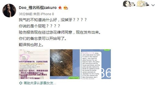 疑中浦悠花好友曝光验伤报告 还晒出打落的两颗牙照片