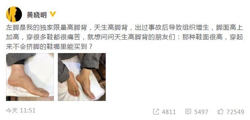 黄晓明回应垫鞋垫 称左脚脚背本来就比较高