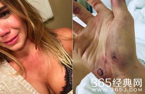 名模女星遭家暴 见血是家常便饭 过着非人的生活