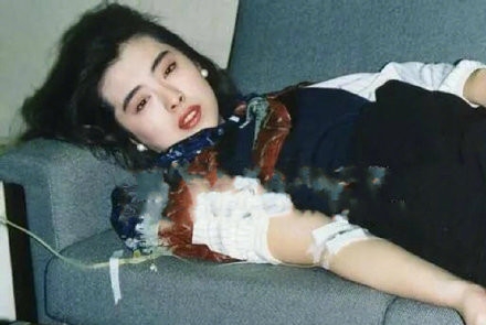 王祖贤早年输液照曝光 王祖贤生病输液照获赞