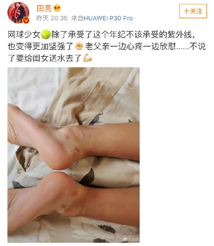 田亮发文森碟练网球练出水泡 遗传爸爸的运动基因