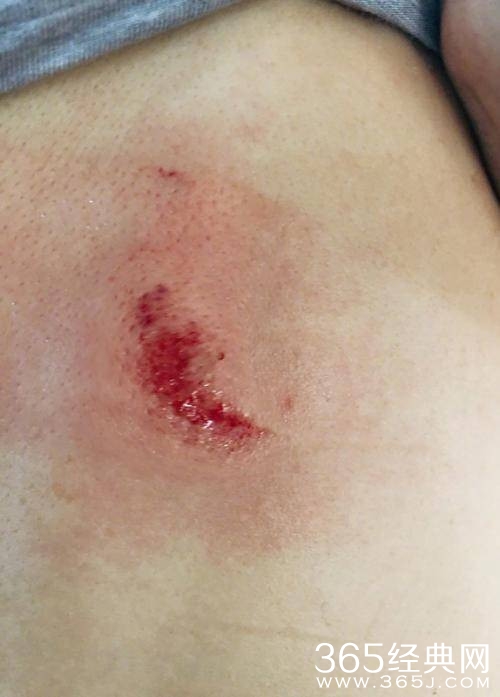 张馨予妈妈受伤 家中柜子倾倒家里一片狼藉