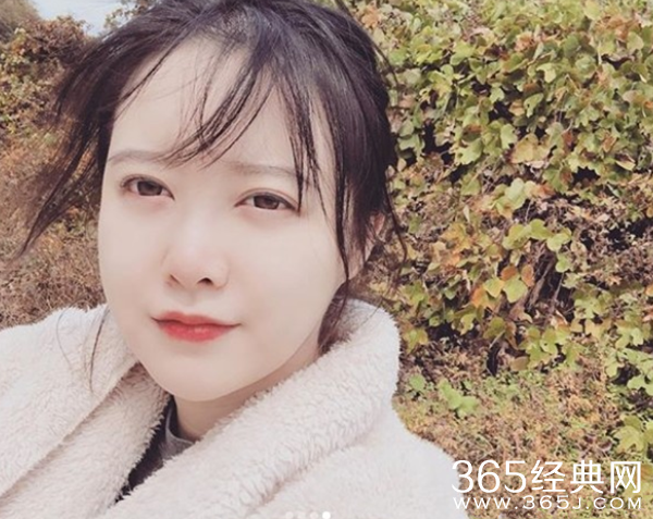 具惠善晒自己脱发照片 与安宰贤离婚后陷入脱发危机？