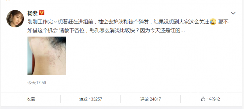 杨紫回应现身整形美容医院 为进组做准备“在线求医”