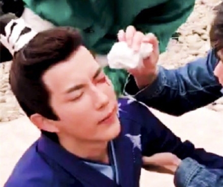 于朦胧发文回应眼睛受伤：没有留下后遗症