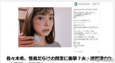 家有美妻出轨还家暴，佐佐木希比不上野花？