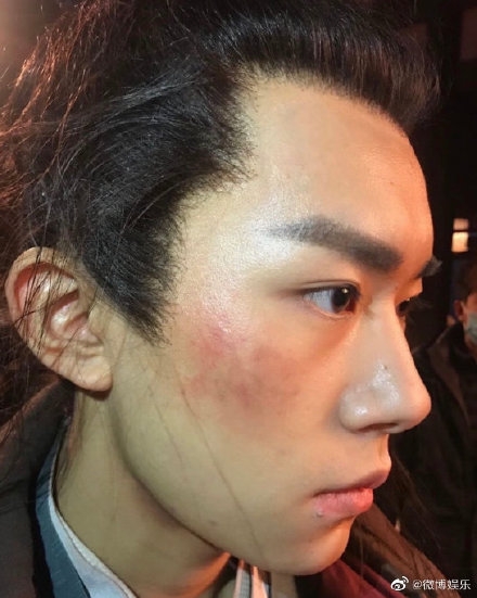 易烊千玺怼脸侧颜照上热搜  这是怎么回事？