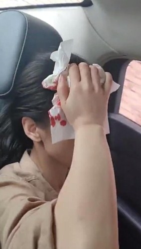 黄圣依拍戏时头部受伤，这到底是怎么回事？